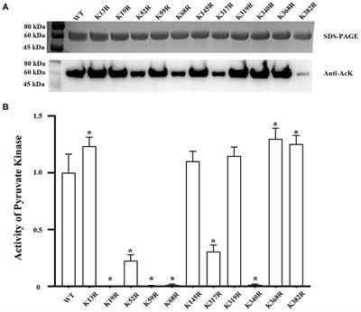 Characterizing the Effect of the Lysine Deacetylation Modification on Enzyme Activity of Pyruvate Kinase I and Pathogenicity of Vibrio alginolyticus